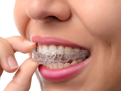 Rekha Gehani, DDS | Interceptive Orthodontics, Orthodontics for Teens and Orthodontics for Children